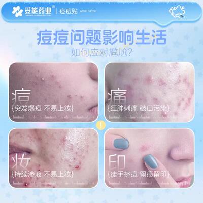 能水杨酸痘痘贴隐形青豆少年可爱水体HOH胶辅料青春期星星豆痘印