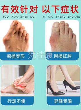 外李时拇拇指CYQ外珍翻膏方正品官旗舰店指关节矫正用涂抹温和舒