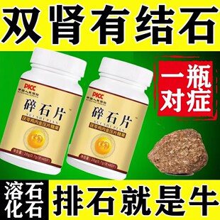 【 排石太快了】鸡内金排石化石溶石去胆囊膀胱肾石结石尿石溶石