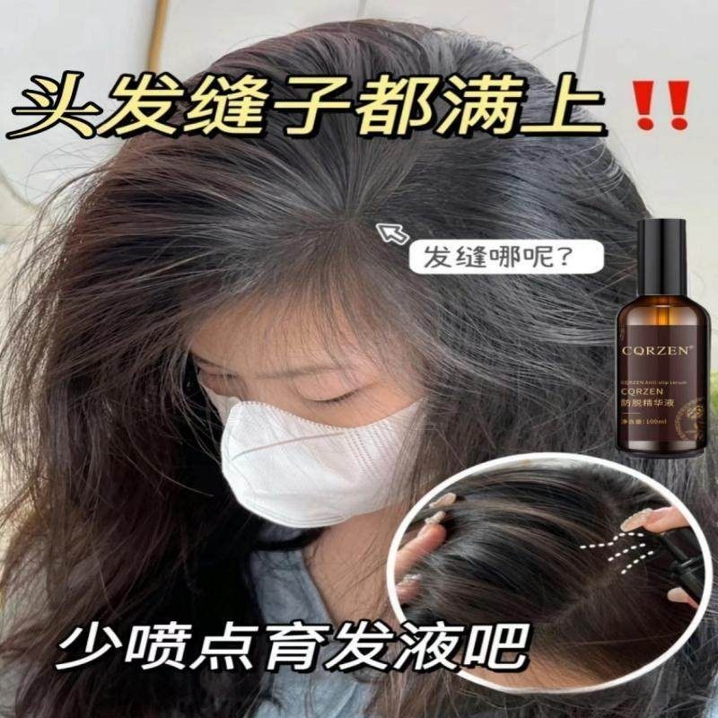 【长发新认证】长发液育发液固发增发密发固发发际线快速增长营养,美发护发/假发,其它护发,淘宝优惠券,粉丝福利购,淘宝优惠卷