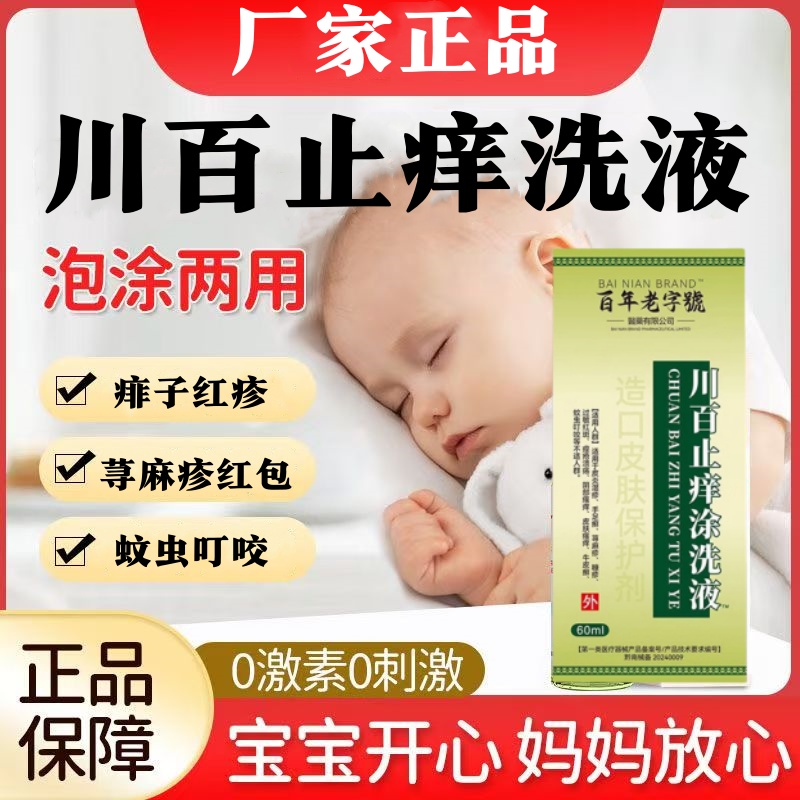 川百止痒涂洗液瘙痒湿荨麻疹
