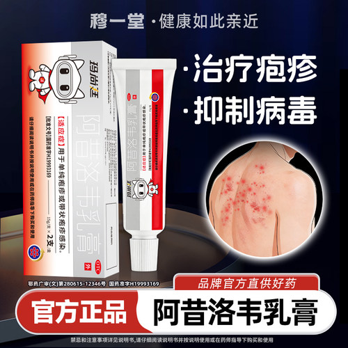 玛尚廷阿昔洛韦乳膏疱疹感染