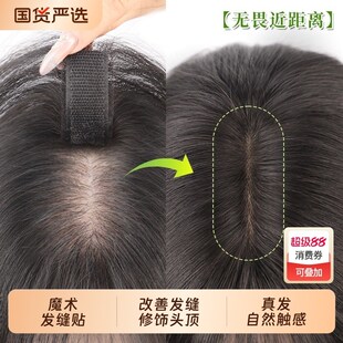 八字假刘海前额自然假发s女片头顶补发无痕缝贴真发隐形真人法式
