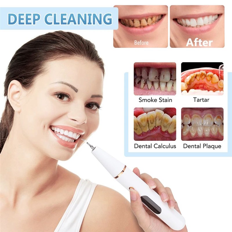 Ultrasonic Dental Calculus Scaler Teeth CleOaner Smoke Stain