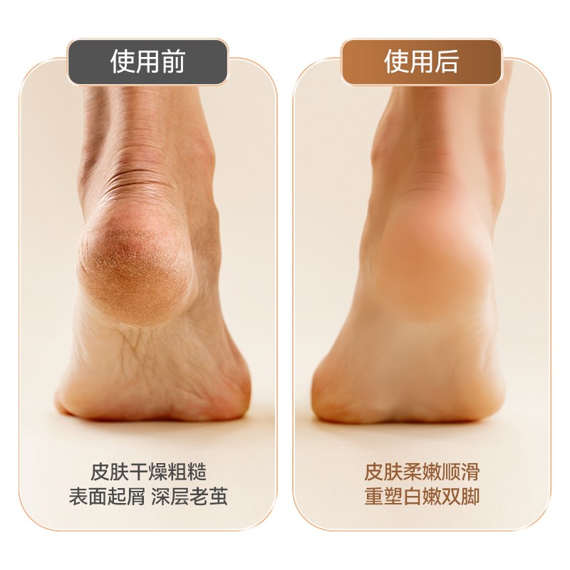 2024新款电动磨脚器修脚神器去死皮老茧家用修足机自动刮脚打磨器