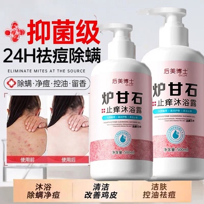 【除螨祛痘】炉甘石止痒洗剂清洁