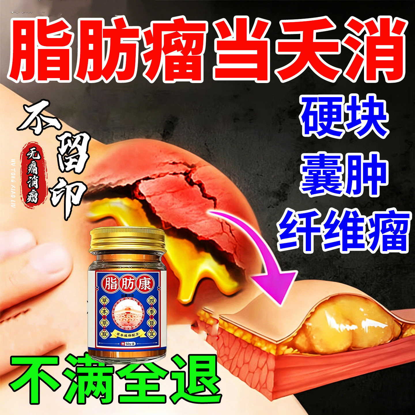 【专攻脂肪瘤】皮下鼓起硬块去除