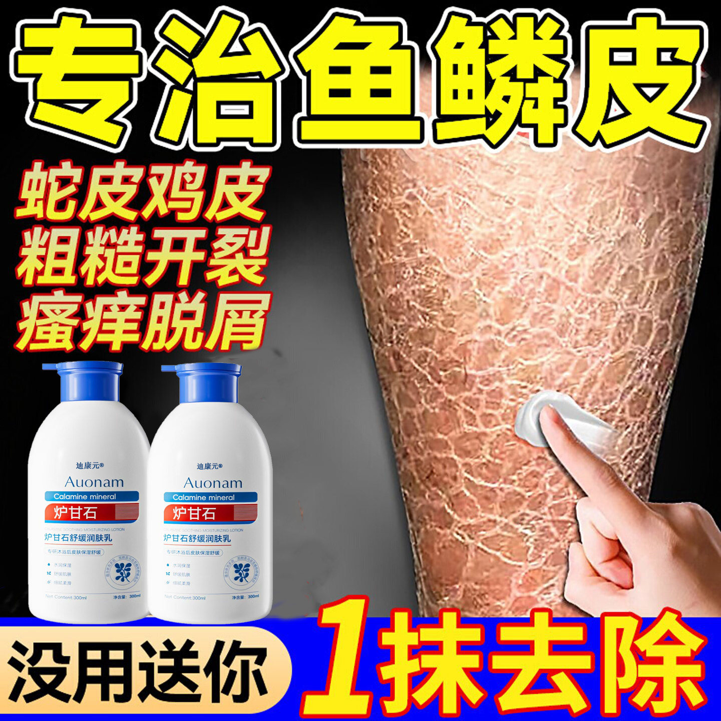 【炉甘石滋润膏】皮肤干裂痒专用
