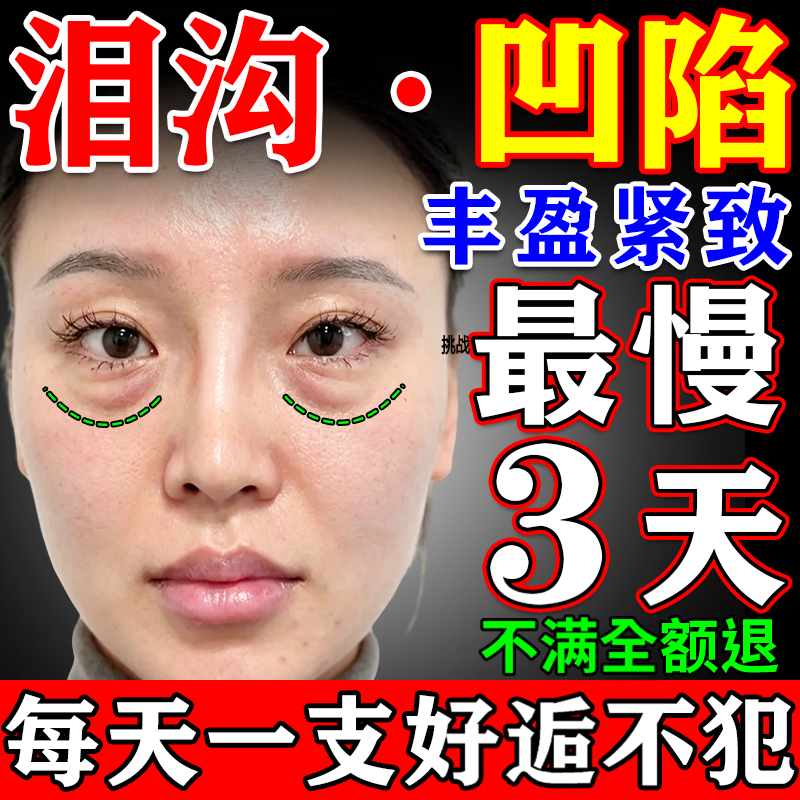 泪沟填充神器眼窝凹陷修复胶原蛋白面部去除法令纹遮眼袋眼霜精华