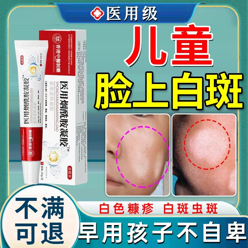 白色糠疹药膏儿童脸上长白斑祛斑乳维生素e乳膏儿童医用烟酰胺UU