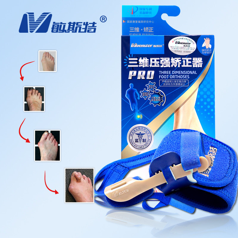 敏斯特拇指外翻脚趾矫正器女可以穿鞋大脚骨矫正器足姆外翻分趾器