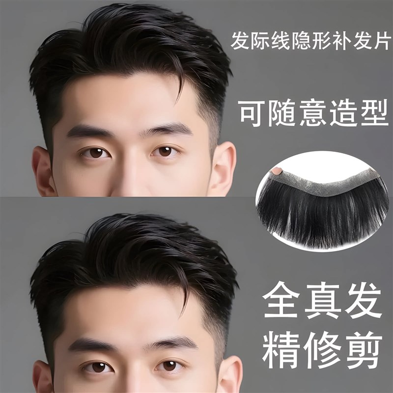 发际线贴男刘海假发片真发男生MA型V型前额无痕隐形轻薄男士假发