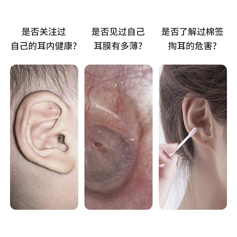 可视挖耳勺掏耳专业采耳工具掏耳朵儿童智能高清发光带灯高清可视