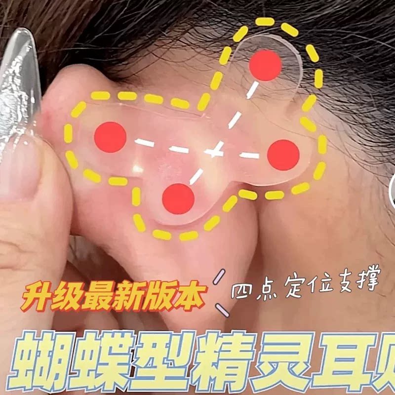 蝴蝶形隐形显脸小定型耳贴