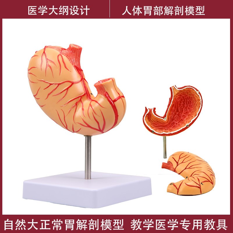 人体胃解剖模型 病理胃模型 自然大胃演示模M型 病变胃 胃穿孔模
