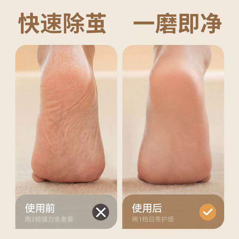 电动磨脚器自动去死皮磨脚修脚神电动修脚器