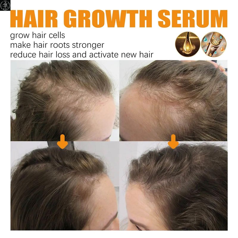 Ginger Hair Fast Growth Serum Spray JBiotin Anti Hair Loss