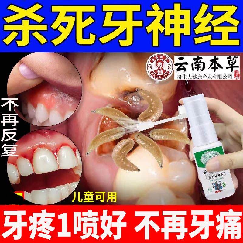 牙痛宁止疼喷雾剂专用药水牙疼杀死牙神经特效的治虫牙蛀牙烂牙齿