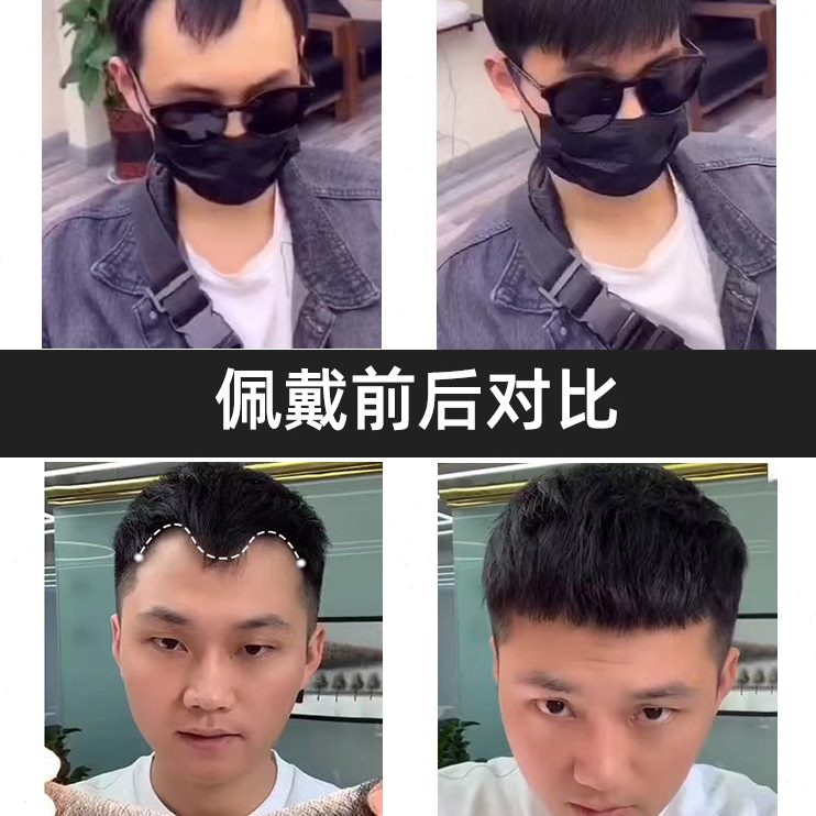 发际线假发刘海贴男士生物头皮自然全真发前额轻薄自然补发片M型