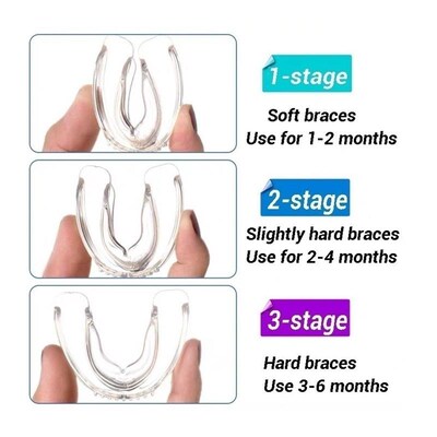 3 Stages Dental Orthodontic zTeeth Silicone Braces Appliance