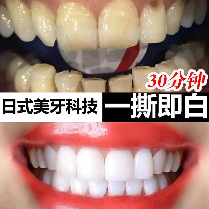 日本牙贴牙齿洁白清洁牙白速效美片膜牙黄店