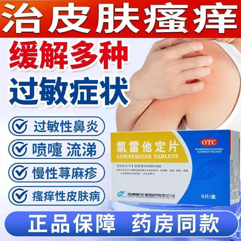 过敏性鼻炎慢性荨麻疹瘙痒性皮肤病 氯雷他定片6片眼部痒及烧灼感