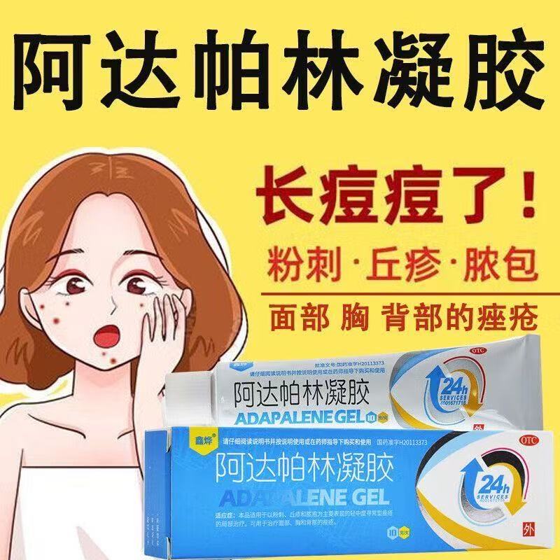 粉刺丘疹脓疱粉刺轻中度寻常型痤疮局部治疗鑫烨阿达帕林凝胶10g