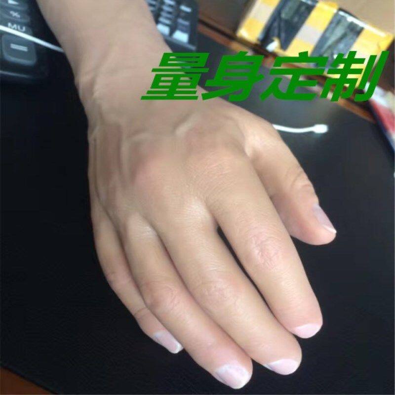 假手 硅胶假肢 量身定做 仿真美容手 手指手掌缺失 肤色仿真【10