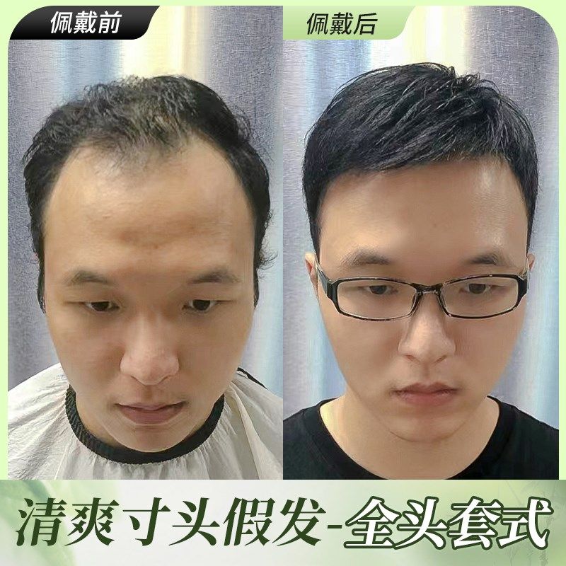 现货男士b假发男生头套夏天薄款真发短发男款真发丝男式假发套免