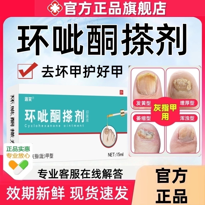 环呲抑菌液酮搽剂官方正品灰指甲