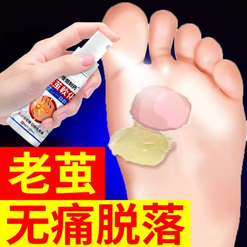 去老茧去除手茧脚底软化剂死皮脚垫去老茧脚茧脚皮膏脚底老茧硬皮