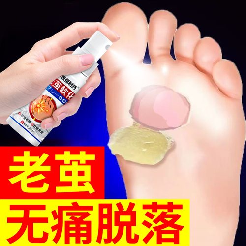 去老茧去除手茧脚底软化剂死皮脚垫去老茧脚茧脚皮膏脚底老茧硬皮