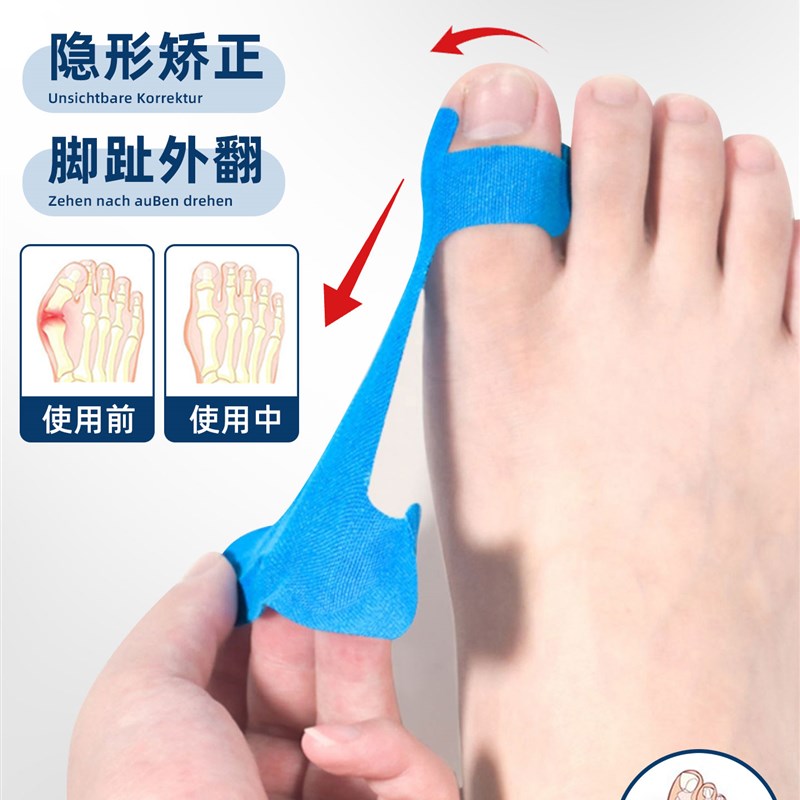 拇指外翻辅助矫正带肌肉贴大脚趾防磨护套透气可穿鞋关节固定绷带