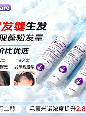 3盒】Xcare英国米诺地尔泡沫剂5%女士生发液防脱生发泡沫剂旗舰店