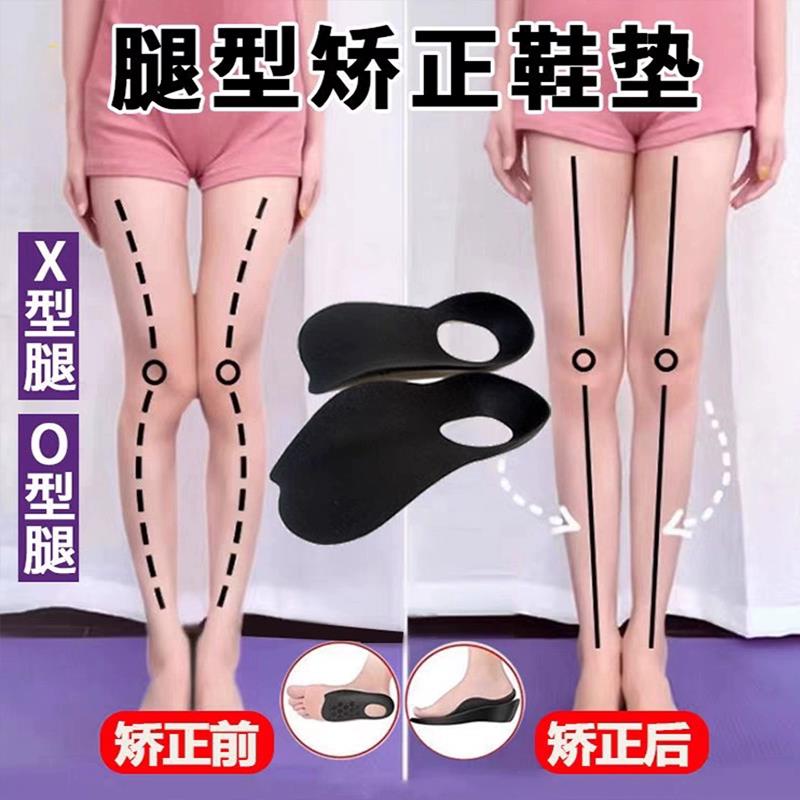 o型腿矫正神器纠正小腿外翻罗圈腿形xo鞋垫腿部儿童腿型x型直腿