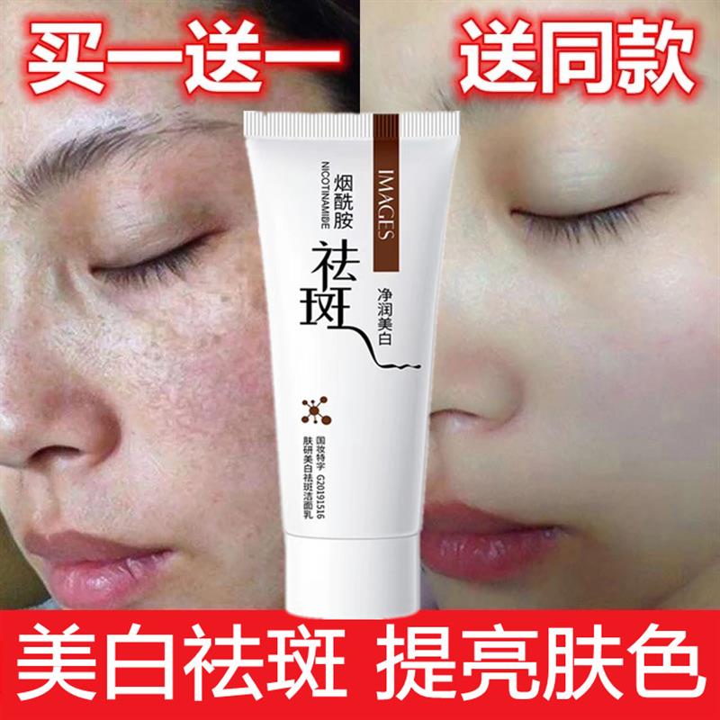 适合妈妈用的洗面奶美白祛斑抗皱提亮肤色30到50岁中年女士专用淡