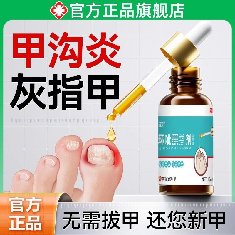环呲抑菌液酮搽剂官方正品灰指甲发黄增厚甲板甲癣护理乳膏非药