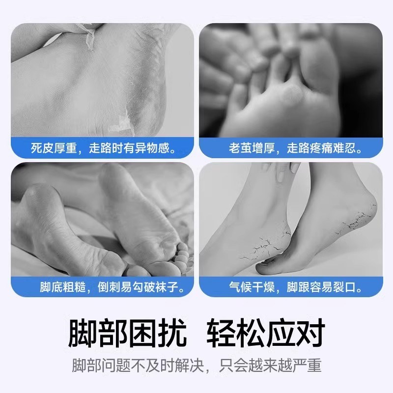 2025新款智能电动修脚器大功率居家去死皮自动打磨足部美容修剪器