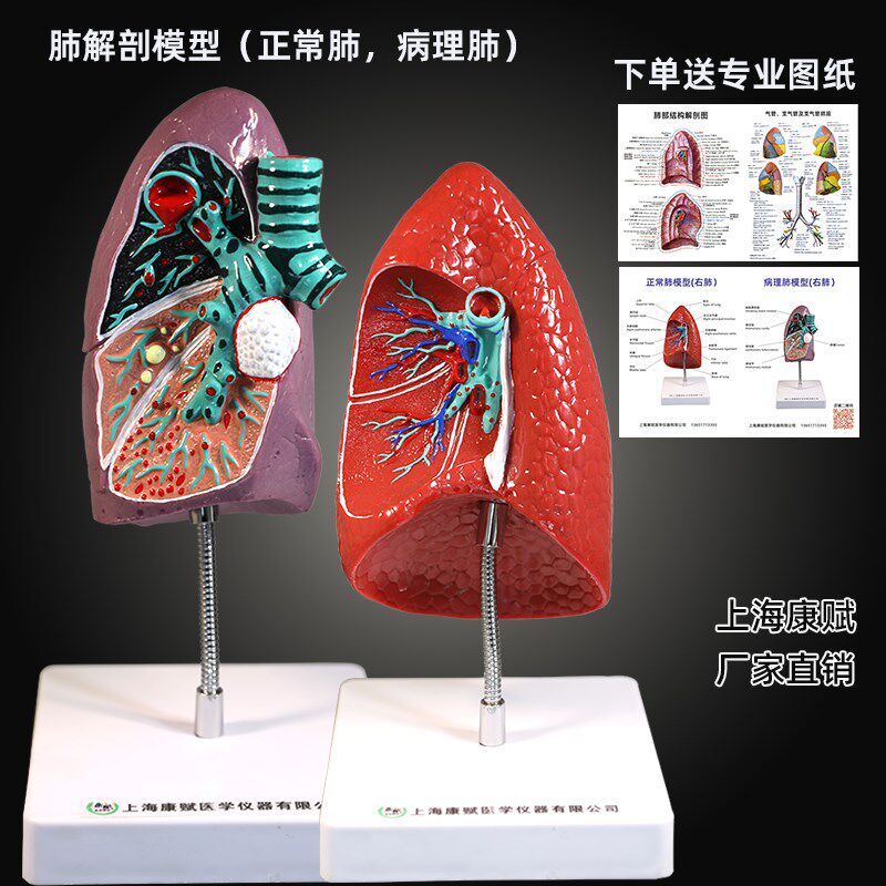 人体自然大肺解剖模型 肺部展示教学 肺结核肺R结节医学病理肺模