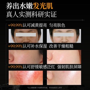 OHBT澳白黄芪爽肤水控油祛痘美白去黄提亮肤色补水保湿 敏感肌专用