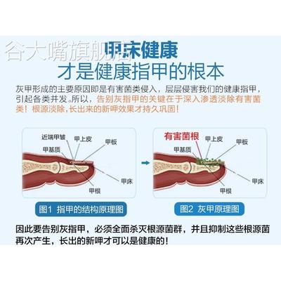 醋精免邮高浓度 泡脚用家用食用白醋80度 包邮杀菌止痒马桶多用途