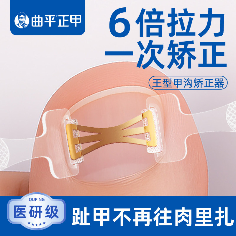 曲平正甲 甲沟嵌甲矫正器贴片医生脚趾甲神器指甲弹丝炎