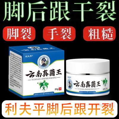 云南真菌王脚后跟手足开裂膏