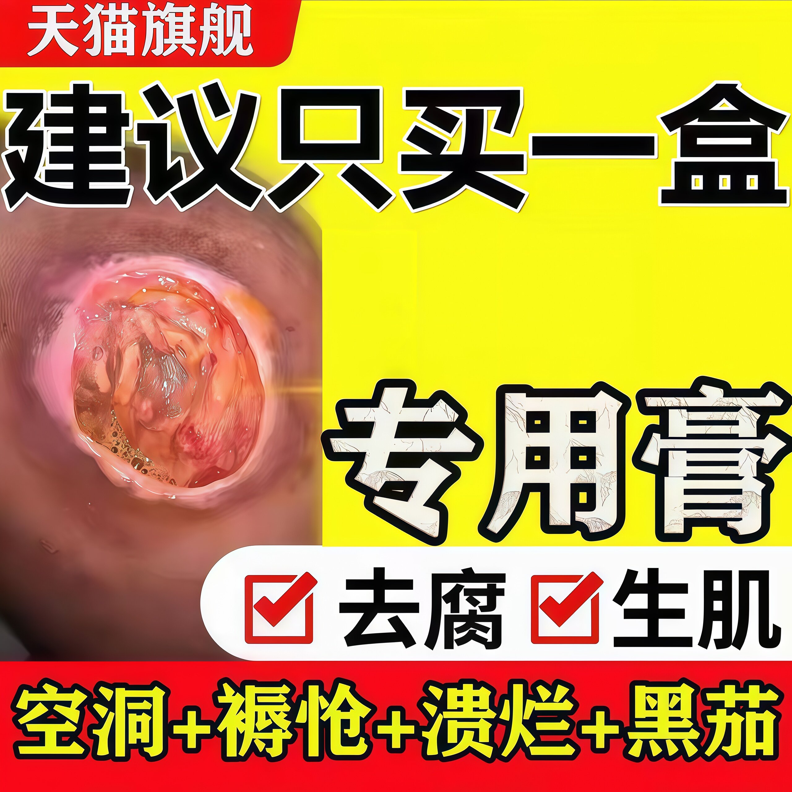 褥疮膏老人臀部皮肤溃烂
