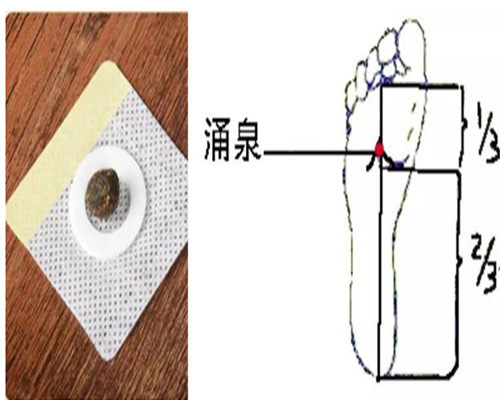 BIKIT宝宝退热贴8个月起适用 改善J咽喉痛与舌质红舒缓易怒情绪