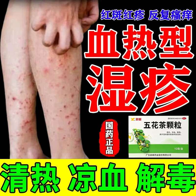 五花茶颗粒血热湿疹皮肤痒湿疹止痒皮肤红肿血热凉血茶解毒清热