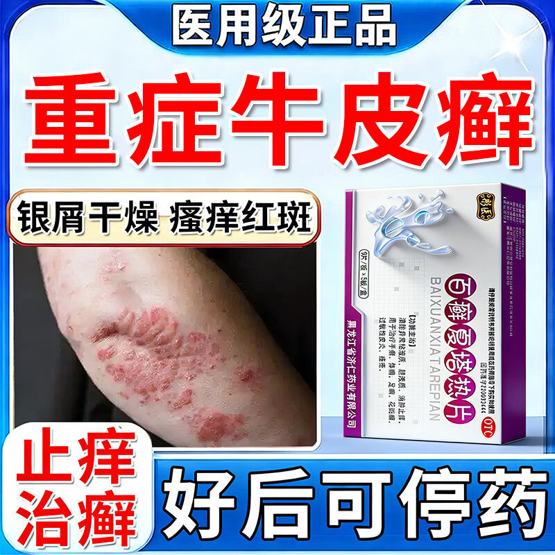 百癣夏塔热片胶囊正牌官方旗舰店治疗顽固牛皮癣银屑专用特药效