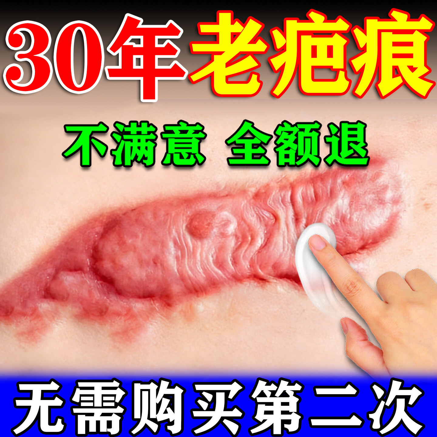 芭贝畅软膏旗舰店凝胶医用硅酮祛疤凝胶去疤膏痕修复无痕祛疤膏,医疗器械,祛疤产品,淘宝优惠券,粉丝福利购,淘宝优惠卷