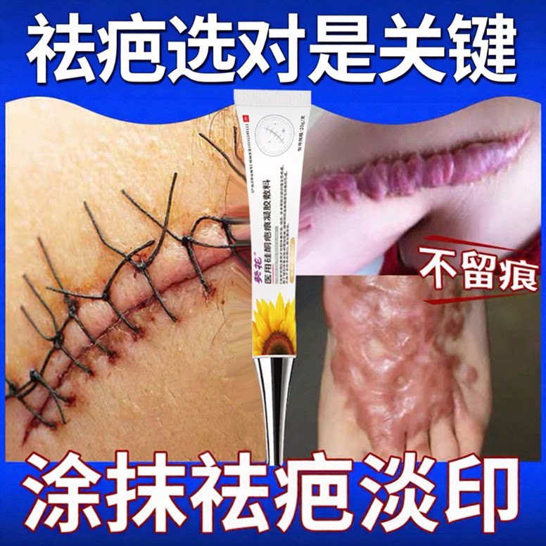美皮护美皮护疤痕贴官方旗舰店