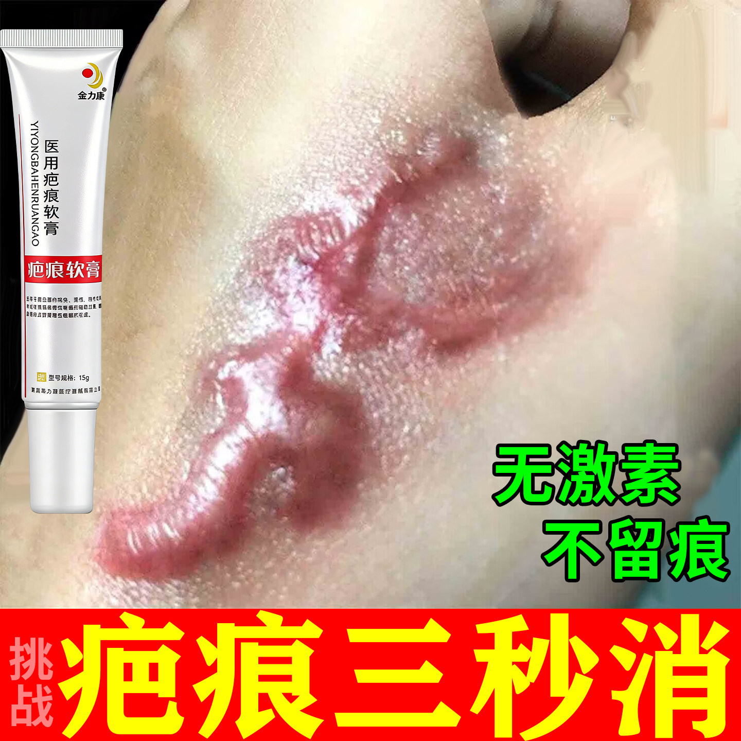 时中笑巴巴清旗舰店祛疤膏去疤膏除疤痕增生凸起去除疙瘩修复凝胶,医疗器械,膏药贴（器械）,淘宝优惠券,粉丝福利购,淘宝优惠卷